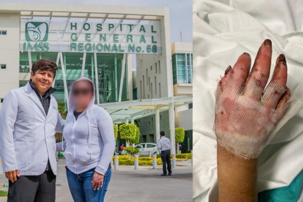 Médicos del IMSS Guanajuato salvan vida y extremidades tras explosión